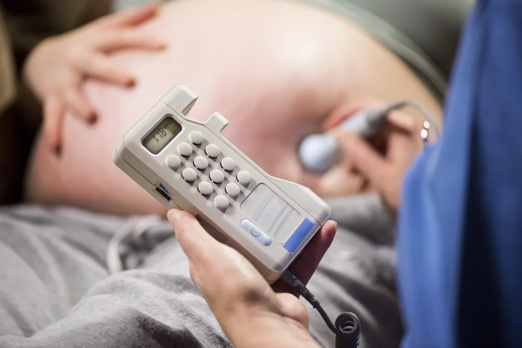 Fetal Heart Monitor